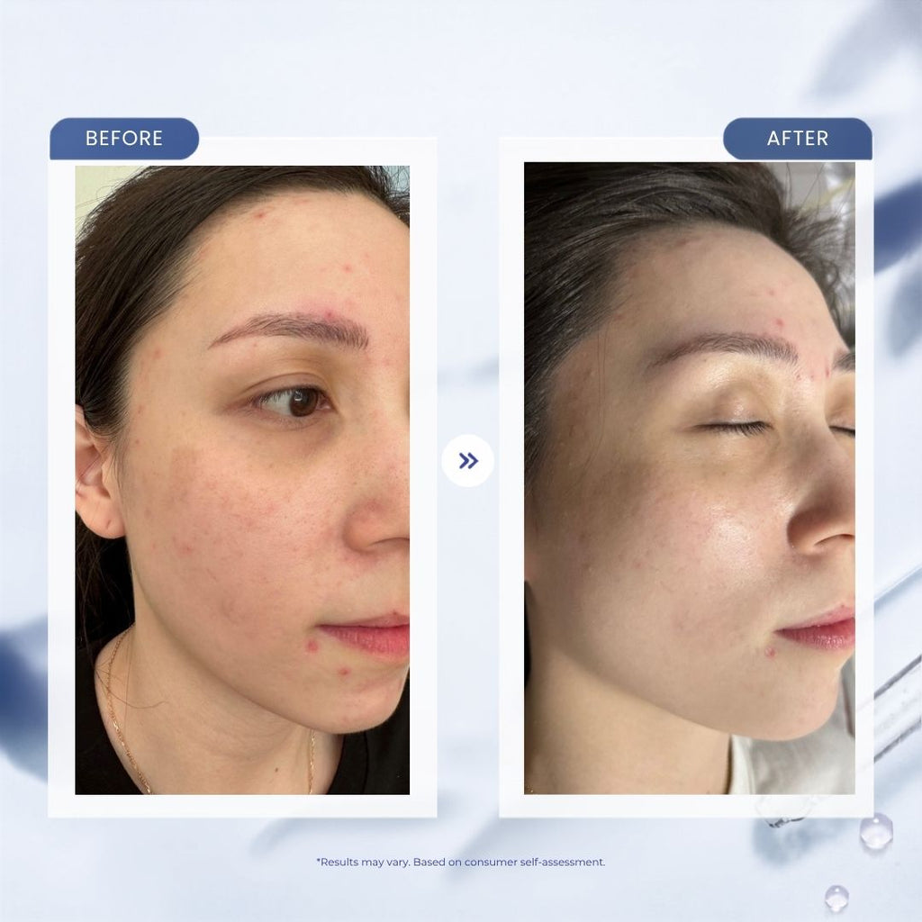 Fade Dark Marks. Calm Redness. One Serum.
