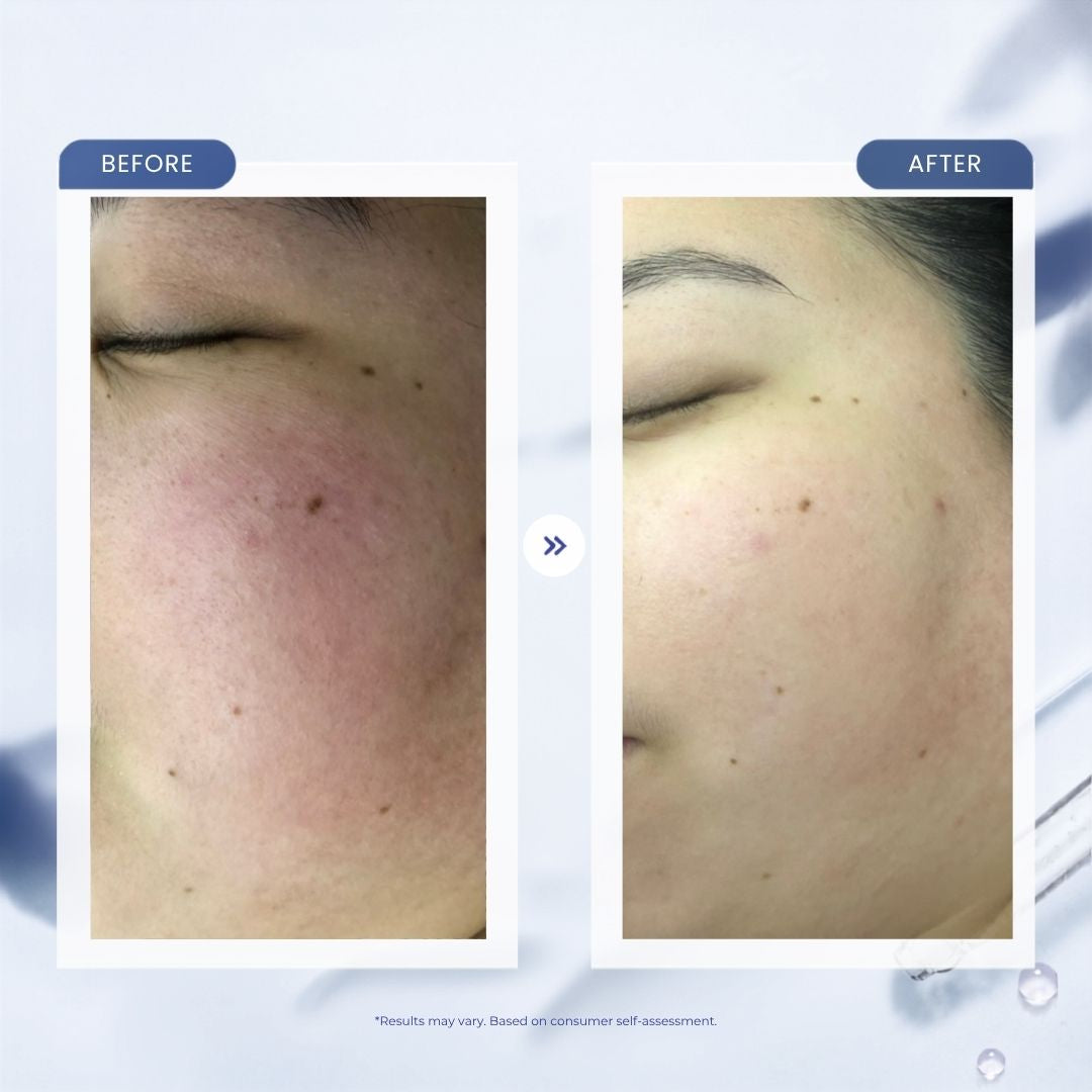 Fade Dark Marks. Calm Redness. One Serum.