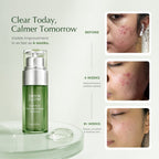 Acne & Blemish Control. Oil Balance. Mark Correction. Skin Repair