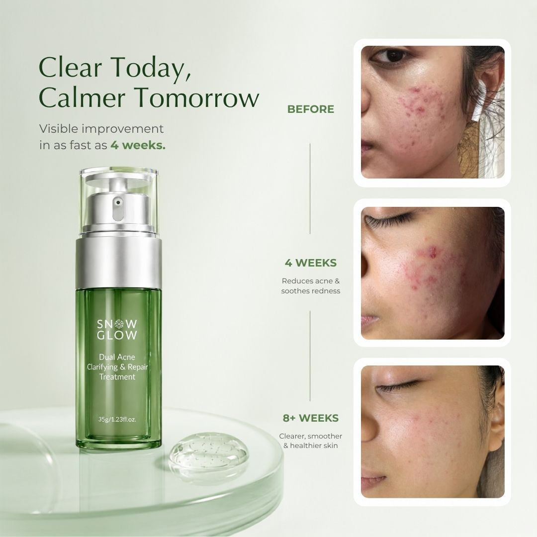 Acne & Blemish Control. Oil Balance. Mark Correction. Skin Repair