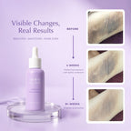 Reveal Bright, Smooth & Confident Underarms