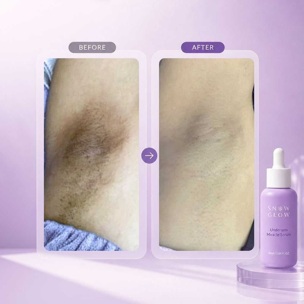 Reveal Bright, Smooth & Confident Underarms