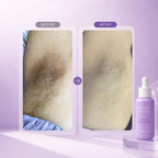 Reveal Bright, Smooth & Confident Underarms