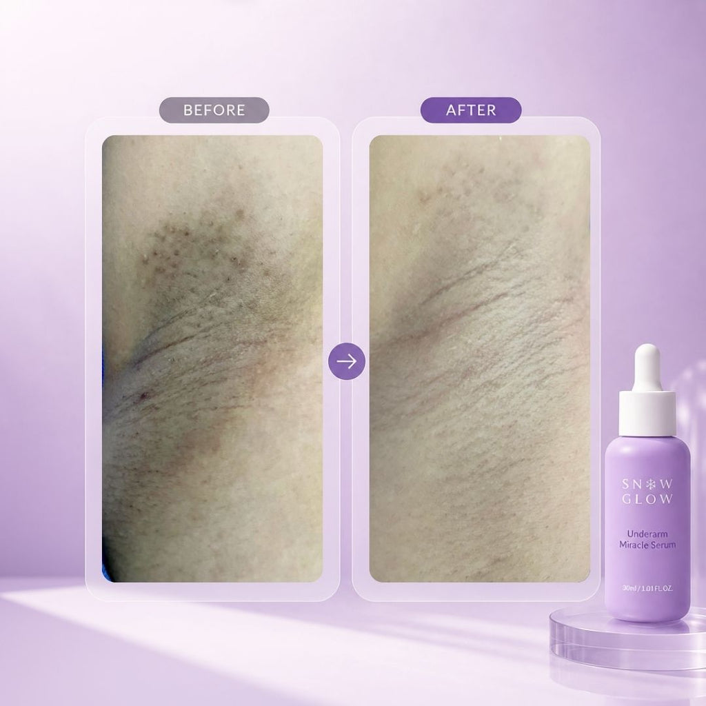 Reveal Bright, Smooth & Confident Underarms