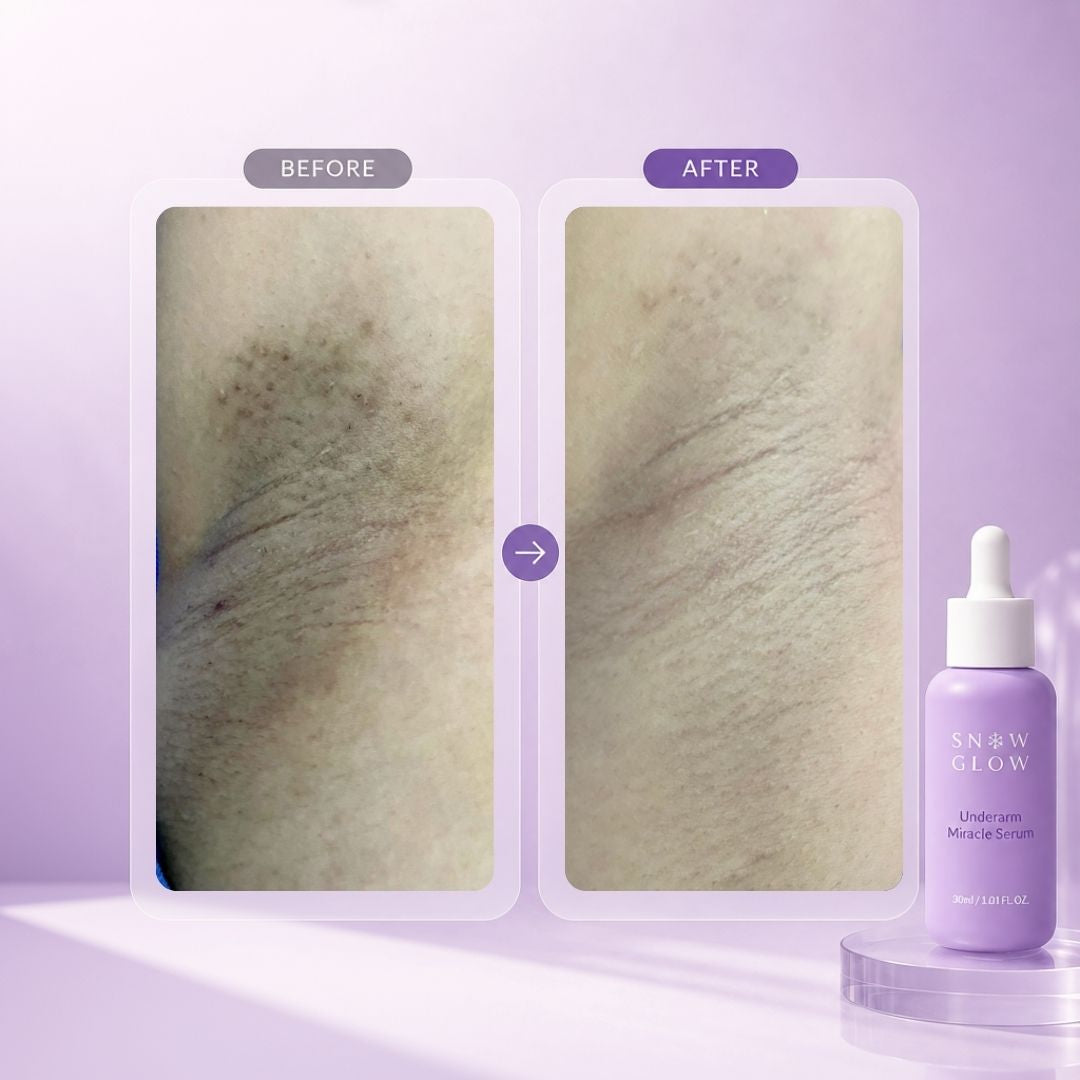 Reveal Bright, Smooth & Confident Underarms