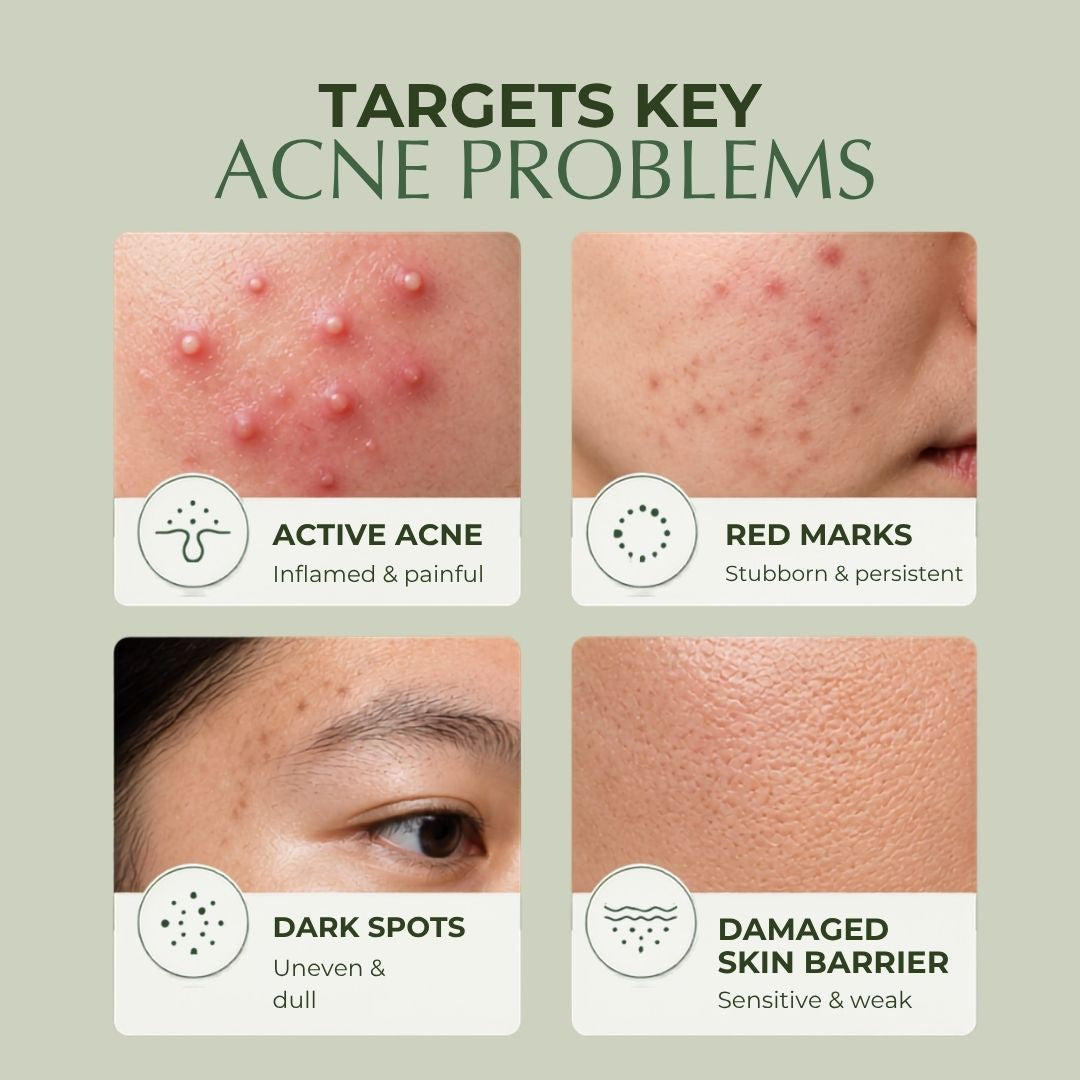 Acne & Blemish Control. Oil Balance. Mark Correction. Skin Repair