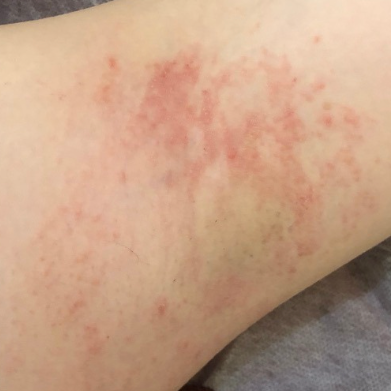 Right Underarm